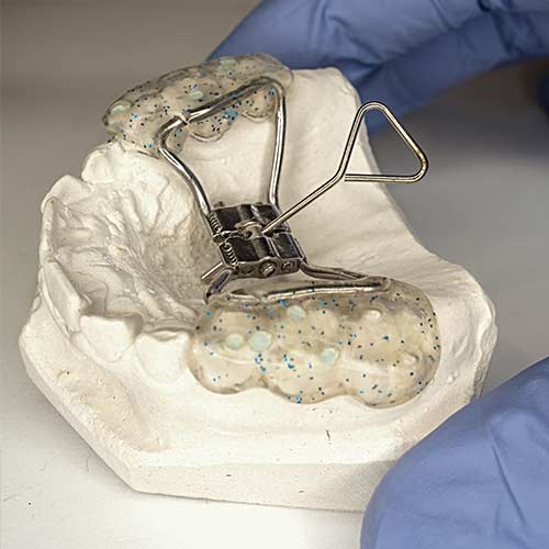 biggs hansen orthodontics indianapolis in types of appliances palatal expander image