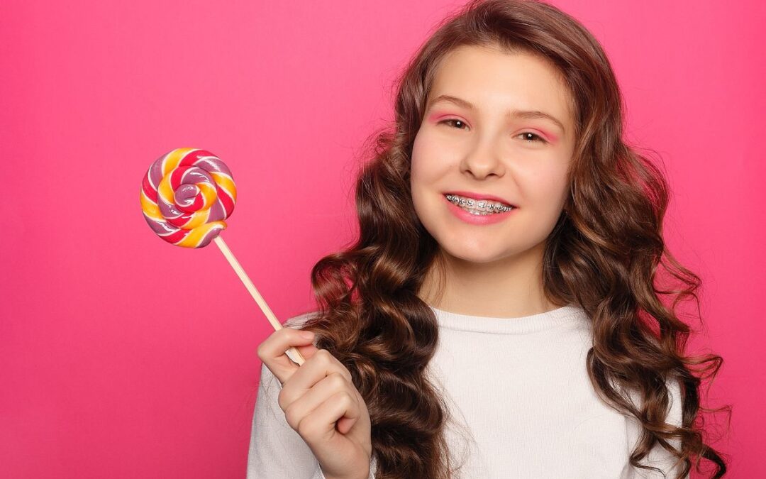 Braces-Safe Candy Options