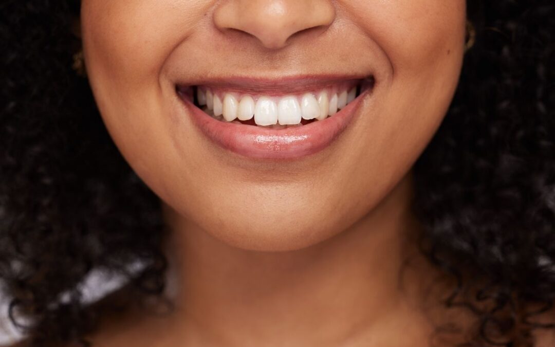 Do You Really Need an Orthodontist for Mild Teeth Misalignment?