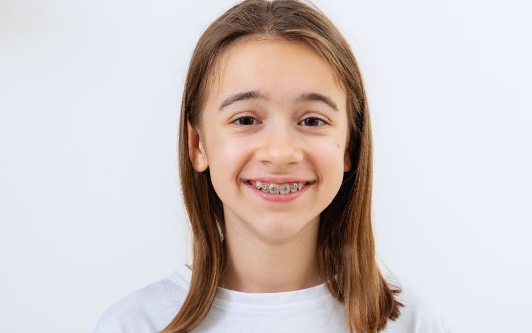 Early vs Late Braces: What Indianapolis Parents Need to Know