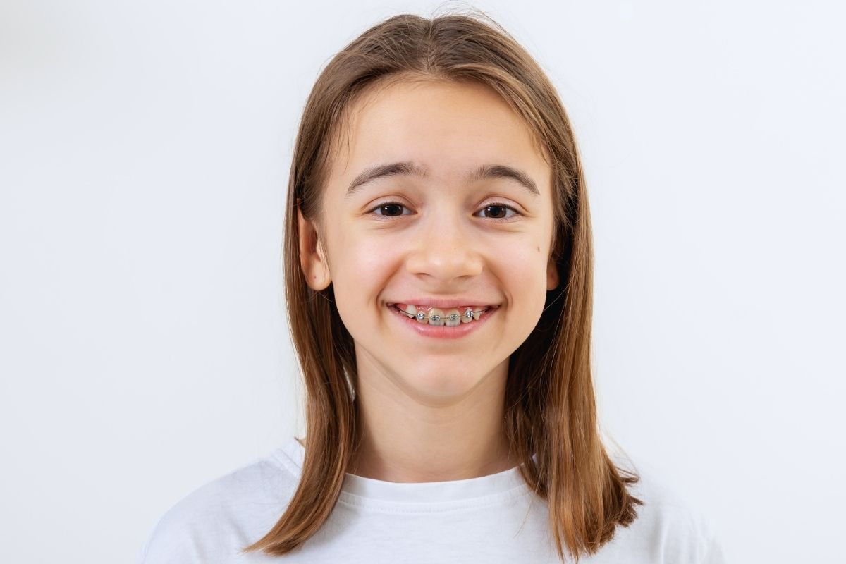 kid with braces what to know about Early vs Late Braces